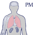 Particulate Matter attacks the lung